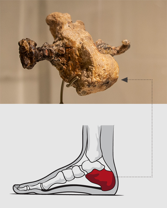 1968년 기브앗 하미브타르(Giv’at ha-Mivtar)에서 발굴된 1세기 유대인의 못이 박힌 발뒤꿈치 뼈이다.